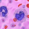 A global study finds that gaps in information and support are linked to poorer quality of life for people with chronic lymphocytic leukaemia. 