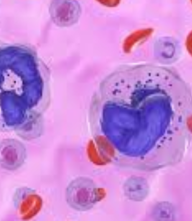 A global study finds that gaps in information and support are linked to poorer quality of life for people with chronic lymphocytic leukaemia. 