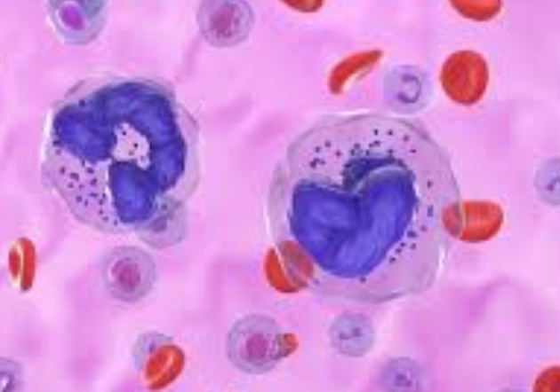 A global study finds that gaps in information and support are linked to poorer quality of life for people with chronic lymphocytic leukaemia. 