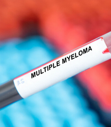 Living with myeloma