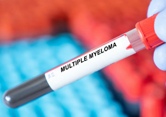 Living with myeloma