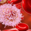 New Trial Investigates Chemotherapy-Free Treatment for Hairy Cell Leukaemia